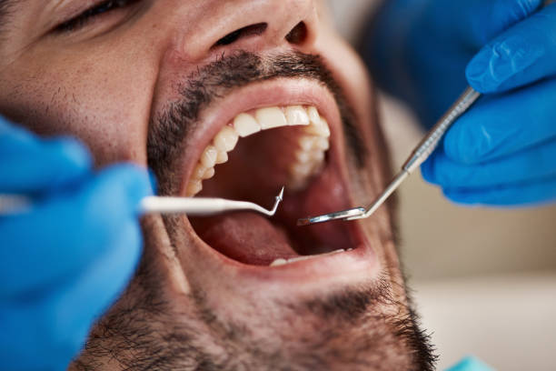 Best Emergency Denture Repair in Carnegie, PA